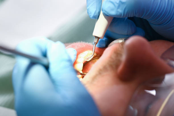 Best Pediatric Emergency Dentist in Sonterra, TX