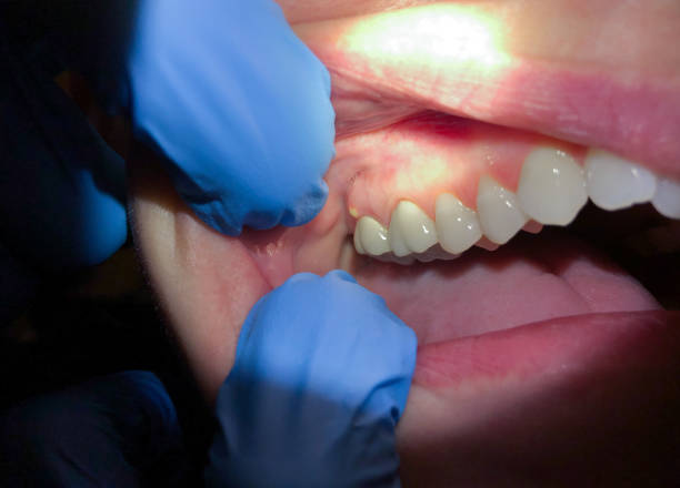 Best Holiday Emergency Dentist in Sonterra, TX